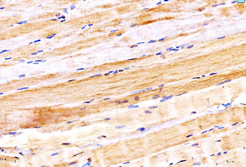 MYH6 Rabbit Polyclonal Antibody
