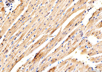 MYH6 Rabbit Polyclonal Antibody