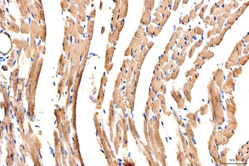 MYH6 Rabbit Polyclonal Antibody