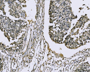 Nac1/NACC1 Rabbit Polyclonal Antibody