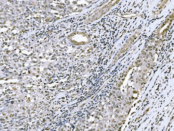 Nac1/NACC1 Rabbit Polyclonal Antibody