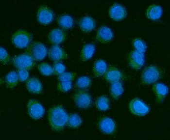 PDGF AA/PDGFA Rabbit Polyclonal Antibody