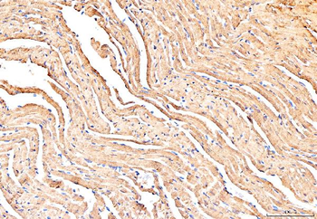 Phospholamban/PLN Rabbit Polyclonal Antibody