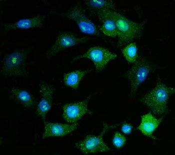 PSMD8 Rabbit Polyclonal Antibody