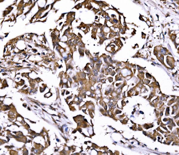 PSMD8 Rabbit Polyclonal Antibody
