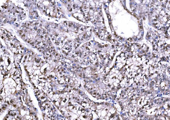 PSMD8 Rabbit Polyclonal Antibody