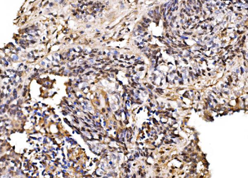 PSMD8 Rabbit Polyclonal Antibody