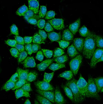 RCC2 Rabbit Polyclonal Antibody
