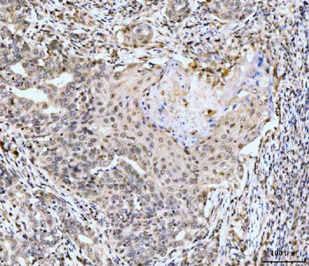 MSK2/RSK-B/RPS6KA4/RSK Rabbit Polyclonal Antibody
