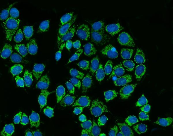SREBP2/SREBF2 Rabbit Polyclonal Antibody