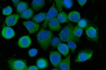 SRI Rabbit Polyclonal Antibody