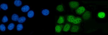 AP2 gamma/TFAP2C Rabbit Polyclonal Antibody