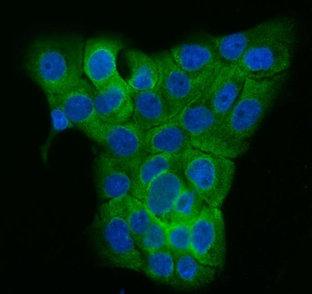 TUBGCP2 Rabbit Polyclonal Antibody