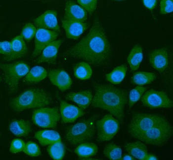 USP9X Rabbit Polyclonal Antibody