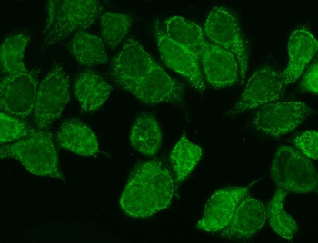 WNT8B Rabbit Polyclonal Antibody