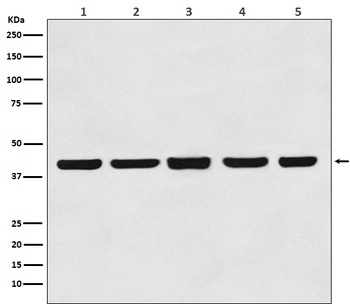 beta Actin Mouse Monoclonal Antibody