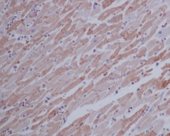 beta Actin Mouse Monoclonal Antibody