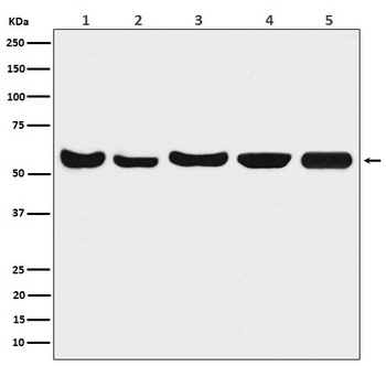 Akt 1/2/3 Rabbit Monoclonal Antibody