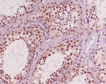 Akt 1/2/3 Rabbit Monoclonal Antibody