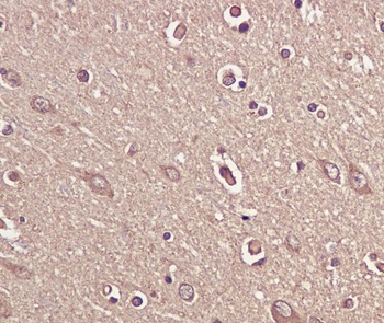 BDNF Rabbit Monoclonal Antibody