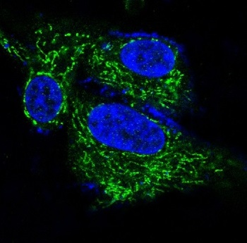 BDNF Rabbit Monoclonal Antibody