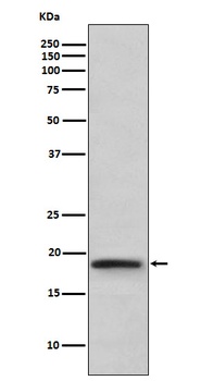 TNF beta Rabbit Monoclonal Antibody