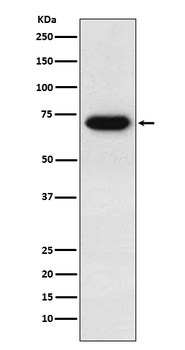 CD39 Rabbit Monoclonal Antibody