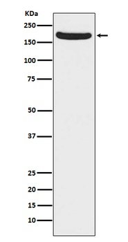 NMDAR2A Rabbit Monoclonal Antibody