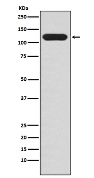 MUC4 Rabbit Monoclonal Antibody
