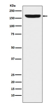 REST/NRSF Rabbit Monoclonal Antibody