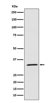 UCP1+UCP3/UCP1 Rabbit Monoclonal Antibody