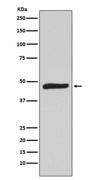 MAPKAP Kinase 2 Rabbit Monoclonal Antibody