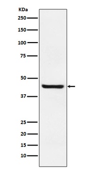 Septin 2 Rabbit Monoclonal Antibody