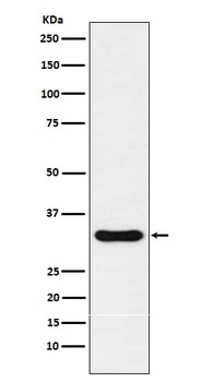 NKX3.1/NKX3 Rabbit Monoclonal Antibody