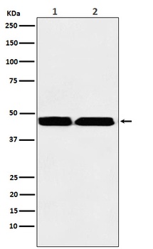 KMT1B/SUV39H2 Rabbit Monoclonal Antibody