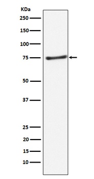 PIAS1 Rabbit Monoclonal Antibody