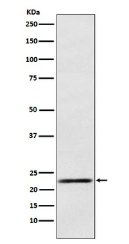 Prolactin Rabbit Monoclonal Antibody