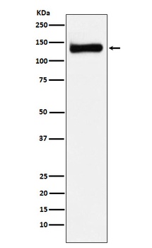 RENT1/hUPF1 Rabbit Monoclonal Antibody