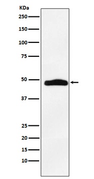 MAPKAP Kinase 2 Rabbit Monoclonal Antibody