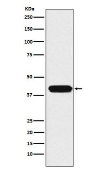 ATOH1 Rabbit Monoclonal Antibody