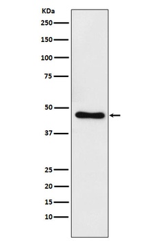 CtBP1 Rabbit Monoclonal Antibody