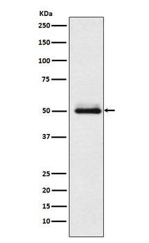 Cytochrome P450 2C9 Rabbit Monoclonal Antibody