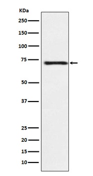 Guanylyl Cyclase beta 1 Rabbit Monoclonal Antibody