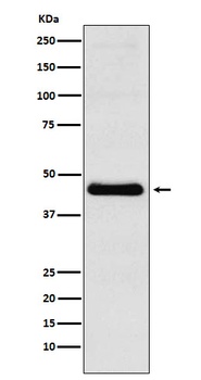 CXCR5 Rabbit Monoclonal Antibody