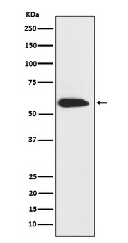 Cytokeratin 6 Rabbit Monoclonal Antibody