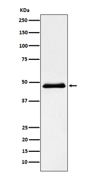 Pancreatic Lipase （PNLIP）/PNLIP Rabbit Monoclonal Antibody