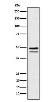 Brachyury Rabbit Monoclonal Antibody