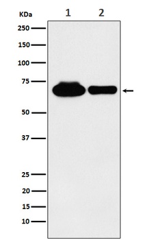 METTL3 Rabbit Monoclonal Antibody