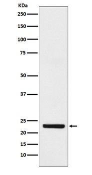 HB EGF Rabbit Monoclonal Antibody