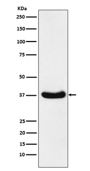 AKR1C3 Rabbit Monoclonal Antibody